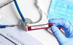 26 के बाद आये 25 ओर कोरोना पॉजीटिव